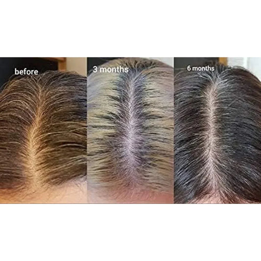 The Ordinary Multi-Peptide Serum for Hair Density – 60ml